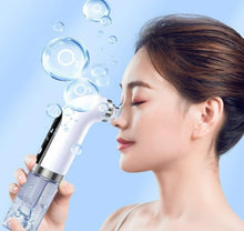 Load image into Gallery viewer, PorePro- Blackhead Remover