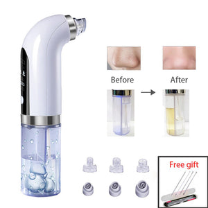 PorePro- Blackhead Remover